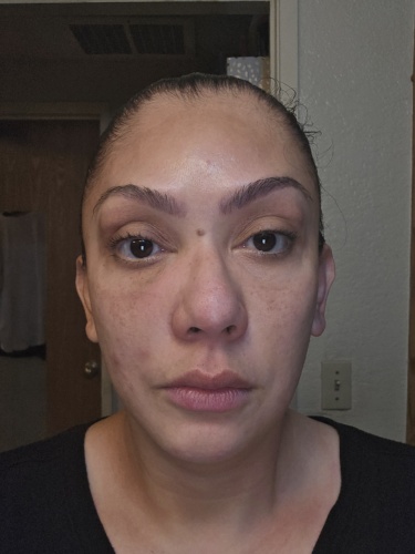 Click to view full screen Metox 200 Units photo review