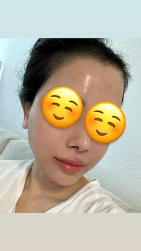 Rejuran Healer photo review