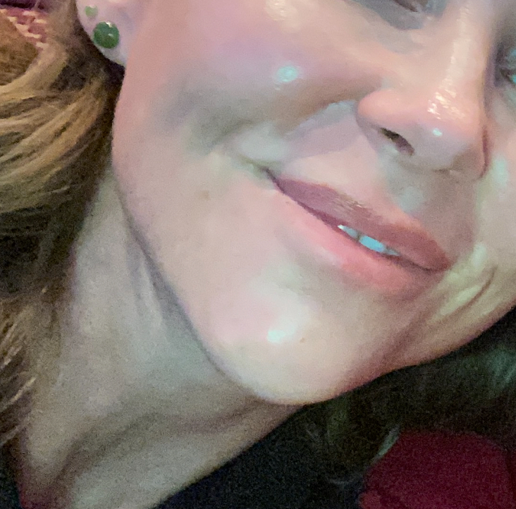 Innotox 100 Units photo review