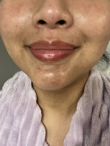 Click to view full screen Celosome SOFT photo review