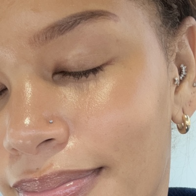 Rejuran Skin Booster photo review
