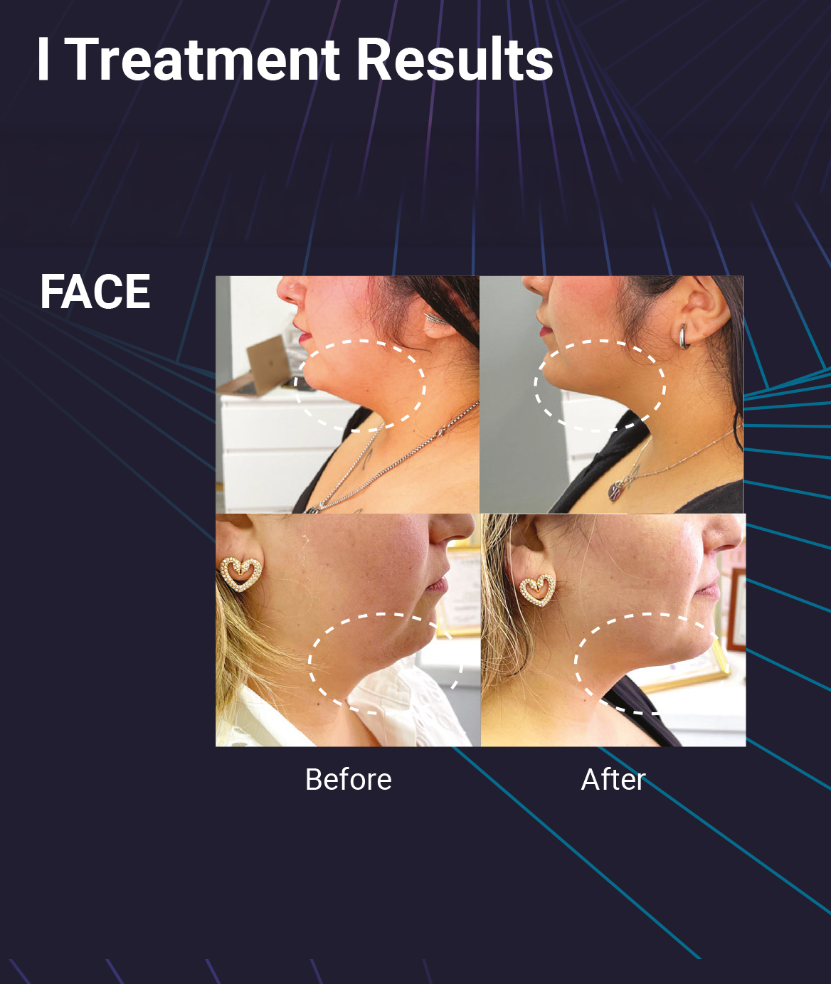 LIPORAH V (for face) - image 15