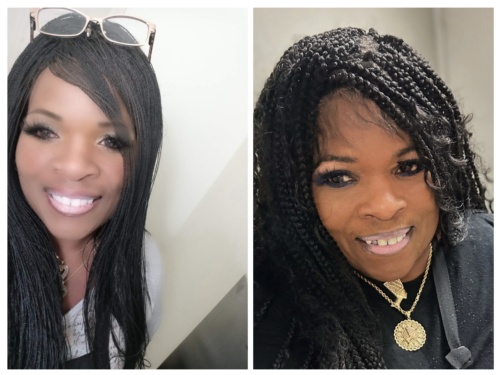 Click to view full screen Dr. Lipo+ V (Face) photo review