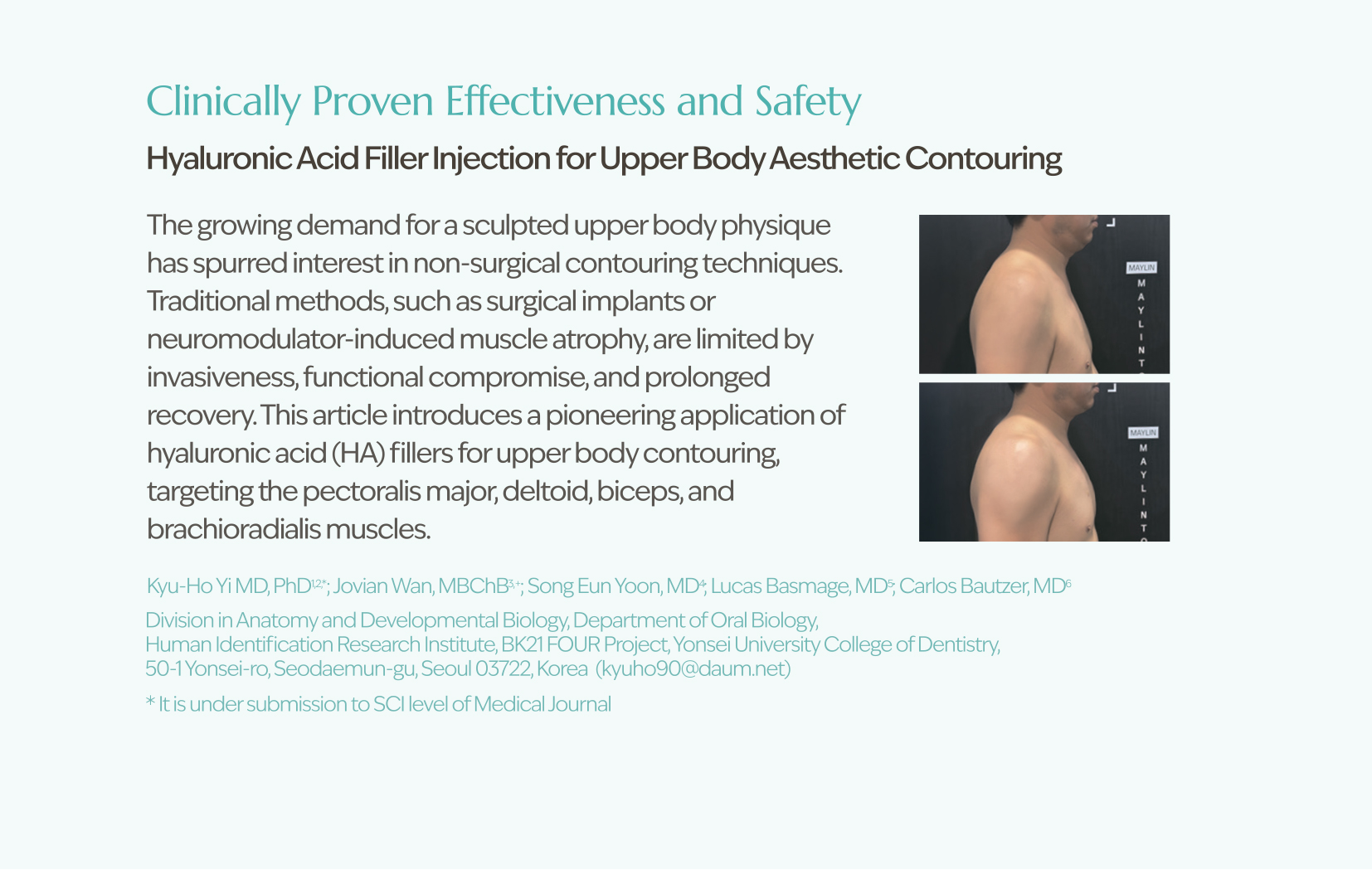 Sedy Fill Body Filler 80ml - image 13