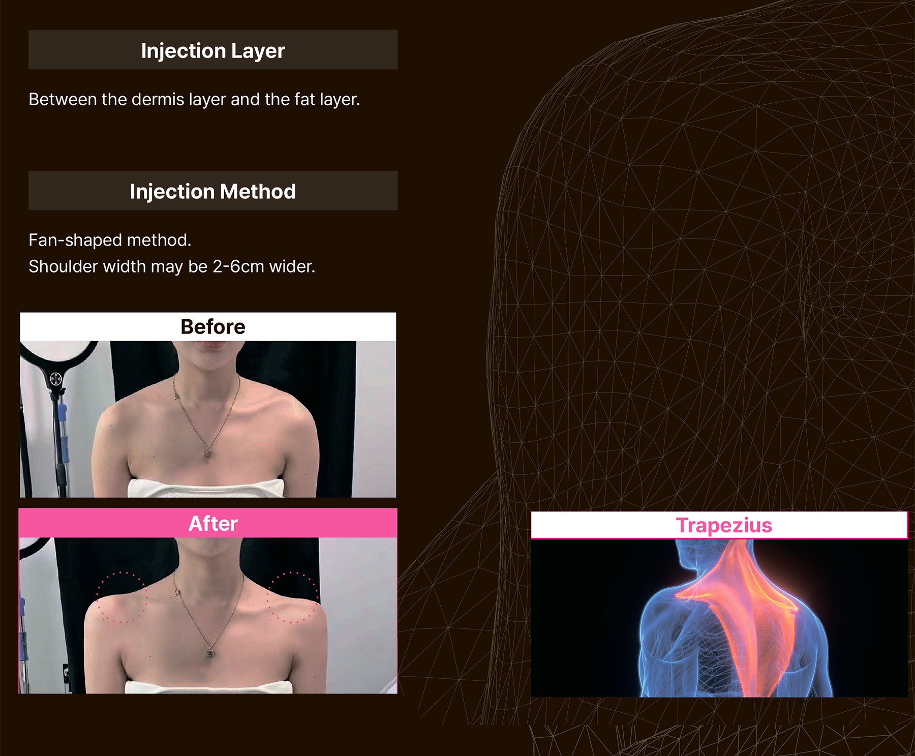 Maxy Fill Body Filler 70 ml - image 24