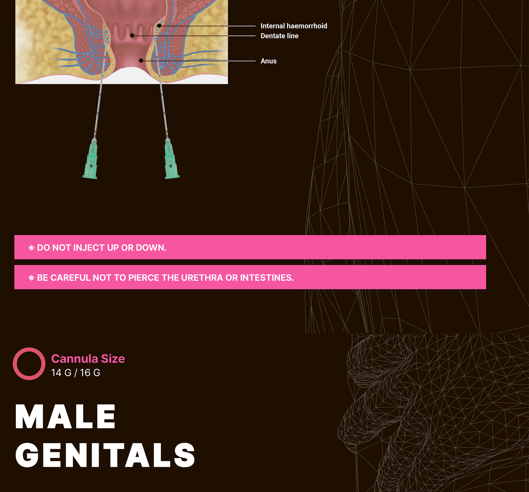 Maxy Fill Body Filler 70 ml - image 26