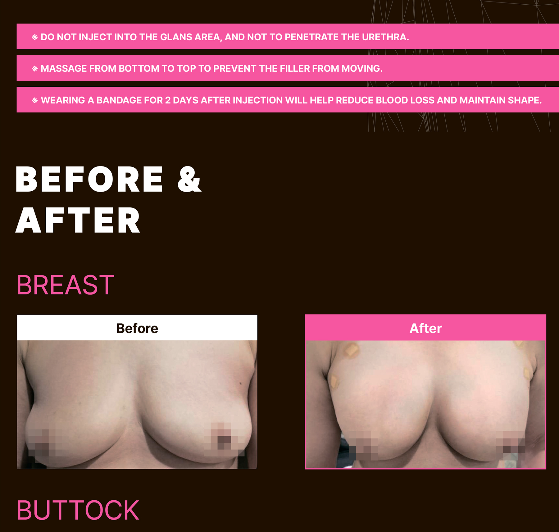 Maxy Fill Body Filler 70 ml - image 28