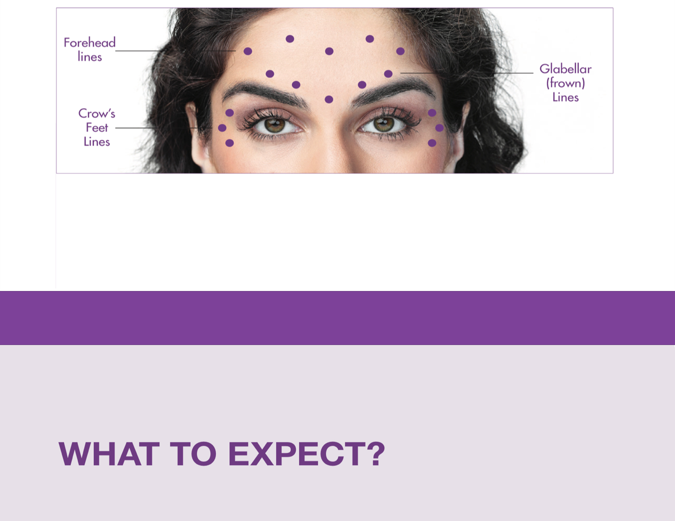 Botox 50 Units - image 15